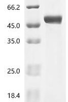 Rickettsia helvetica Citrate synthase (gltA) Recombinant Protein - BioCrest Sci