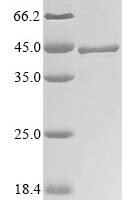 Shigella flexneri Type 3 secretion system translocon protein SctE (sctE), partial Recombinant Protein - BioCrest Sci