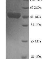 Human respiRatory syncytial virus B Fusion glycoprotein F0 (F), partial Recombinant Protein - BioCrest Sci