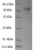Human Ribokinase (RBKS), partial Recombinant Protein - BioCrest Sci