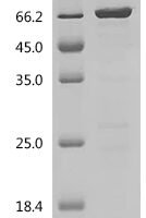 Human GTPase KRas (KRAS) (G12C), partial, Biotinylated Recombinant Protein - BioCrest Sci