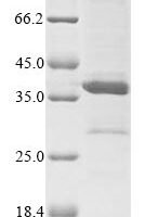 Human respiratory syncytial virus A Major surface glycoprotein G (G), partial Recombinant Protein, N-10His/C-Myc - BioCrest Sci