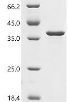 Escherichia coli O6:H1 DNA-binding dual transcriptional regulator OmpR (ompR) Recombinant Protein, C-10His - BioCrest Sci