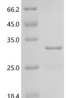 Tetronarce californica Acetylcholine receptor subunit alpha (CHRNA1), partial Recombinant Protein, C-His, aa 25–234, E.coli - BioCrest Sci