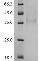 Bovine coronavirus Spike glycoprotein (S), partial Recombinant Protein, C-His, aa 314–634, strain F15 - BioCrest Sci
