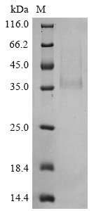 Bovine coronavirus Spike glycoprotein (S), partial Recombinant Protein, C-His, aa 314–634, strain F15, Bovine coronavirus (strain F15) (BCoV) (BCV), Yeast, C-terminal 6xHis-tagged, 36.6 kDa, purity >≥ 85% as determined by SDS-PAGE.