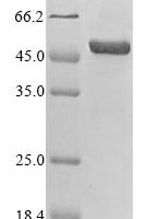 Porcine circovirus 2 Capsid protein (Cap) Recombinant Protein, N-10His-SUMO/C-Myc - BioCrest Sci