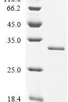 Human Cation-independent mannose-6-phosphate receptor (IGF2R), partial Recombinant Protein, N-His - BioCrest Sci