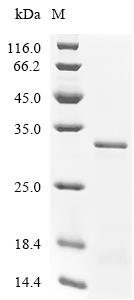 Human Cation-independent mannose-6-phosphate receptor (IGF2R), partial Recombinant Protein, N-His, E.coli, N-terminal 6xHis-tagged, 25.3 kDa, purity >≥ 85% as determined by SDS-PAGE.
