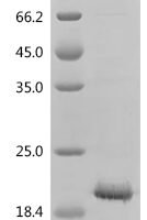 Mouse C-type natriuretic peptide (Nppc) Recombinant Protein, N-His/C-His - BioCrest Sci
