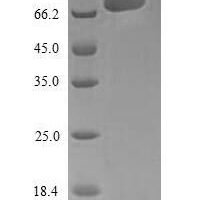 Human Sprouty-related, EVH1 domain-containing protein 1 (SPRED1) Recombinant Protein - BioCrest Sci
