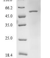 Human Elongation factor Tu, mitochondrial (TUFM) Recombinant Protein, N-His - BioCrest Sci