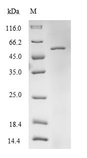 Human Elongation factor Tu, mitochondrial (TUFM) Recombinant Protein, N-His, Homo sapiens (Human), E.coli, N-terminal 6xHis-tagged, 49.0 kDa, purity >≥ 85% as determined by SDS-PAGE.