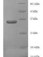 Saccharomyces cerevisiae 26S proteasome regulatory subunit RPN13 (RPN13) Recombinant Protein - BioCrest Sci