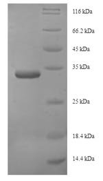 Saccharomyces cerevisiae 26S proteasome regulatory subunit RPN13 (RPN13) Recombinant Protein, Saccharomyces cerevisiae (strain ATCC 204508 / S288c) (Baker's yeast), E.coli, N-terminal 6xHis-SUMO-tagged, 33.8 kDa, purity >≥ 90% as determined by SDS-PAGE.