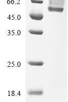 Rat Ectonucleotide pyrophosphatase/phosphodiesterase family member 7 (Enpp7), partial Recombinant Protein, C-His - BioCrest Sci