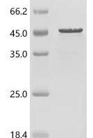 Human Isovaleryl-CoA dehydrogenase, mitochondrial (IVD) Recombinant Protein - BioCrest Sci
