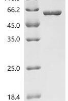Human V-type proton ATPase subunit B,brain isoform (ATP6V1B2) Recombinant Protein, C-His - BioCrest Sci