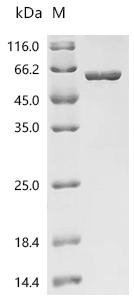 Human V-type proton ATPase subunit B,brain isoform (ATP6V1B2) Recombinant Protein, C-His, Homo sapiens (Human), E.coli, C-terminal 6xHis-tagged, 63.4 kDa, purity >≥ 90% as determined by SDS-PAGE.