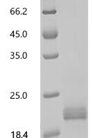 Mouse VIP peptides (Vip) Recombinant Protein, N-His-SUMOstar - BioCrest Sci