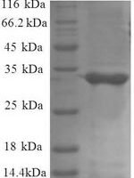 Escherichia coli 50S ribosomal protein L34 (rpmH) Recombinant Protein - BioCrest Sci