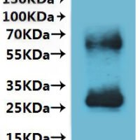 Human Somatostatin receptor type 5 (SSTR5)-VLPs Recombinant Protein - BioCrest Sci