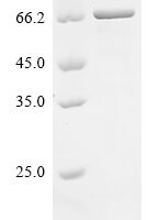 Human Forkhead box protein C1 (FOXC1) Recombinant Protein, N-His - BioCrest Sci