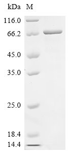Human Forkhead box protein C1 (FOXC1) Recombinant Protein, N-His, Homo sapiens (Human), E.coli, N-terminal 6xHis-tagged, 62.8 kDa, purity >≥ 85% as determined by SDS-PAGE.