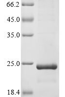 Feline coronavirus Non-structural protein 7a (7a), partial Recombinant Protein - BioCrest Sci