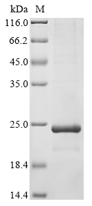 Feline coronavirus Non-structural protein 7a (7a), partial Recombinant Protein, Feline coronavirus (strain FIPV WSU-79/1146) (FCoV), E.coli, N-terminal 10xHis-SUMO-tagged and C-terminal Myc-tagged, 19.7 kDa, purity >≥ 85% as determined by SDS-PAGE.