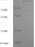 Human S-phase kinase-associated protein 2 (SKP2) Recombinant Protein, N-His-SUMO - BioCrest Sci