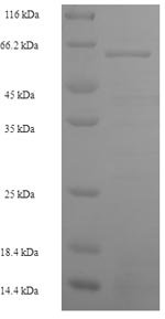 Human S-phase kinase-associated protein 2 (SKP2) Recombinant Protein, N-His-SUMO, Homo sapiens (Human), E.coli, N-terminal 6xHis-SUMO-tagged, 63.8 kDa, purity >≥ 90% as determined by SDS-PAGE.