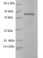 Human Cyclin-dependent kinase 2-associated protein 1 (CDK2AP1) Recombinant Protein - BioCrest Sci