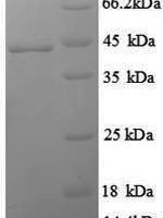 Rat Interferon gamma (Ifng) Recombinant Protein, N-GST - BioCrest Sci