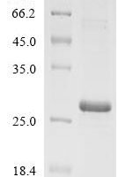 Chicken Gallin protein (gallin_2) Recombinant Protein - BioCrest Sci
