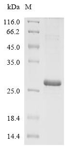 Chicken Gallin protein (gallin_2) Recombinant Protein, Gallus gallus (Chicken), E.coli, N-terminal 6xHis-SUMO-tagged, 22.9 kDa, purity >≥ 85% as determined by SDS-PAGE.
