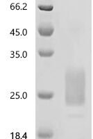 Macaca fascicularis macrophage colony-stimulating factor 1 isoform X1 (CSF1), partial Recombinant Protein - BioCrest Sci