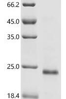 Human papillomavirus type 26 Protein E7 (E7) Recombinant Protein - BioCrest Sci