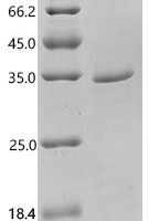Rat Tonin (Klk2) Recombinant Protein, C-His, aa 25–259, E.coli - BioCrest Sci