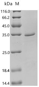 Rat Tonin (Klk2) Recombinant Protein, C-His, aa 25–259, E.coli, Rattus norvegicus (Rat), E.coli, C-terminal 6xHis-tagged, 32.6 kDa, purity >≥ 90% as determined by SDS-PAGE.