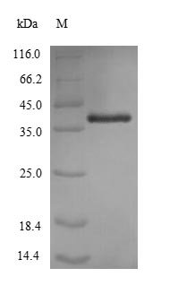 Acinetobacter baumannii Outer membrane protein Omp38 (omp38) Recombinant Protein, N-His - BioCrest Sci