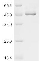 Coccidioides immitis Endochitinase 1 (CTS1) Recombinant Protein, C-His, aa 18–427, Yeast - BioCrest Sci