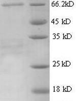 Mouse Alpha-fetoprotein (Afp) Recombinant Protein - BioCrest Sci