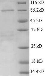 Mouse Alpha-fetoprotein (Afp) Recombinant Protein, Mus musculus (Mouse), Yeast, N-terminal 6xHis-tagged, 67.3 kDa, purity >≥ 90% as determined by SDS-PAGE.