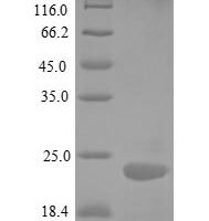 Human Tumor necrosis factor receptor superfamily member 25 (TNFRSF25), partial Recombinant Protein, N-His, aa 25–199, E.coli - BioCrest Sci