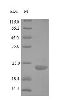 Human Tumor necrosis factor receptor superfamily member 25 (TNFRSF25), partial Recombinant Protein, N-His, aa 25–199, E.coli, Homo sapiens (Human), E.coli, N-terminal 6xHis-tagged, 22.9 kDa, purity >≥ 90% as determined by SDS-PAGE.