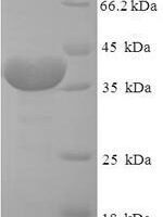 Human Peptidyl-prolyl cis-trans isomerase FKBP14 (FKBP14) Recombinant Protein - BioCrest Sci
