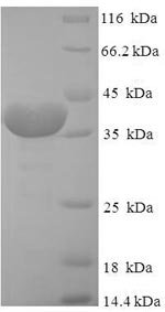 Human Peptidyl-prolyl cis-trans isomerase FKBP14 (FKBP14) Recombinant Protein, Homo sapiens (Human), E.coli, N-terminal 6xHis-SUMO-tagged, 38.0 kDa, purity >≥ 90% as determined by SDS-PAGE.