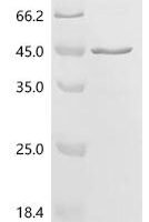Human Synemin (SYNM), partial Recombinant Protein - BioCrest Sci