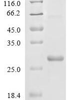 Bovine Beta-defensin 2 (DEFB2) Recombinant Protein - BioCrest Sci
